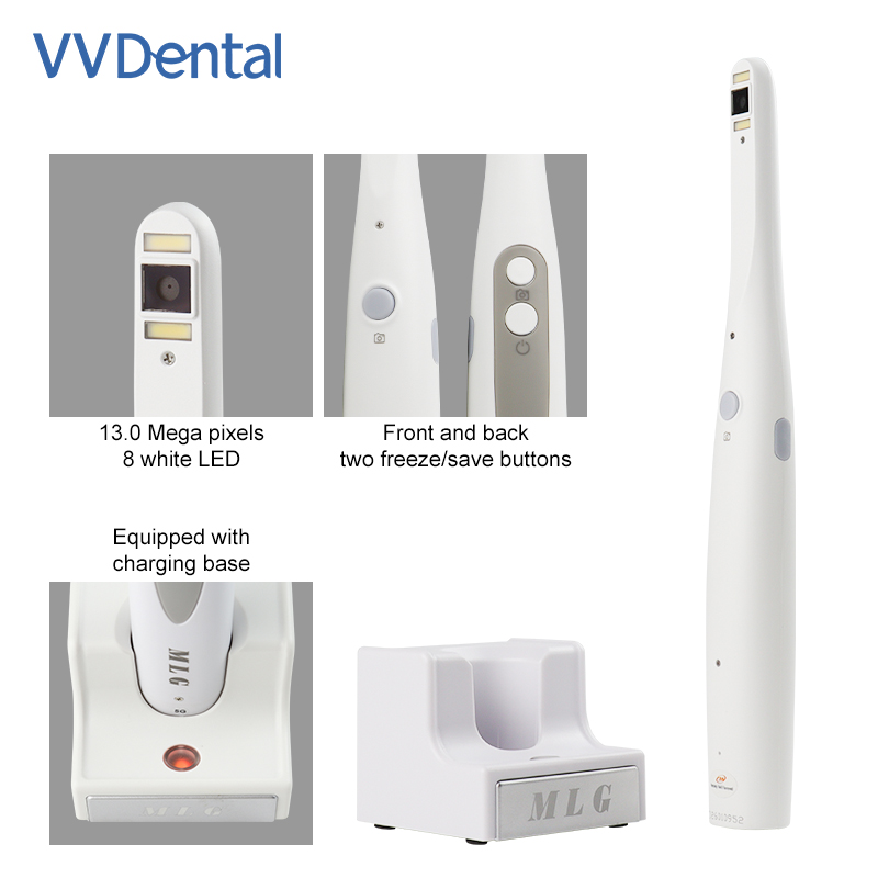 Cámara Intraoral Dental Inalám - Photography Dental reseña y precio