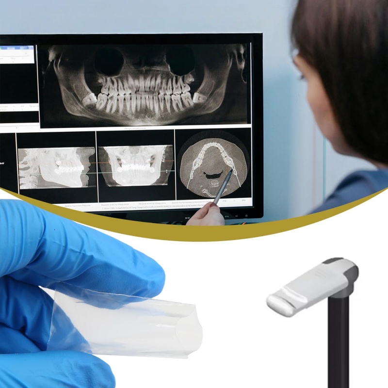 200 unidades/caja Fundas prote - Photography Dental reseña y precio