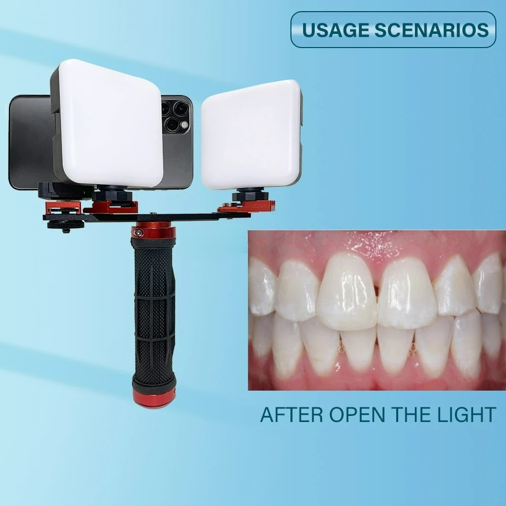 Luz de Fotografía Dental para  - Photography Dental reseña y precio