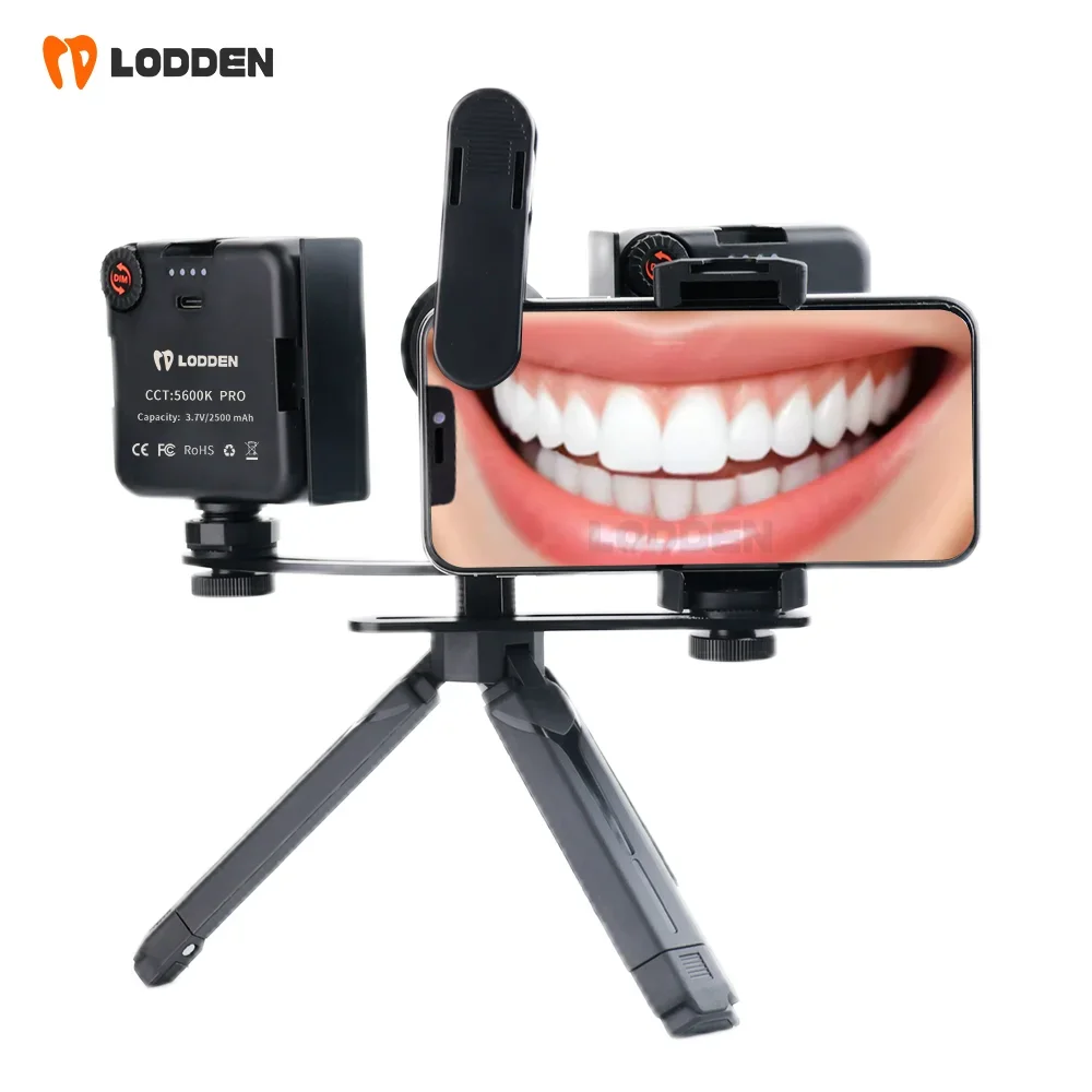 LODDEN Luz de relleno Dental c - Photography Dental reseña y precio