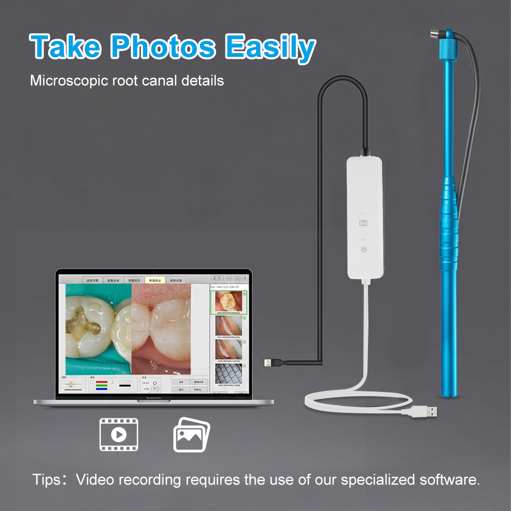 Cámara intraoral micro de 5MP, - Photography Dental reseña y precio
