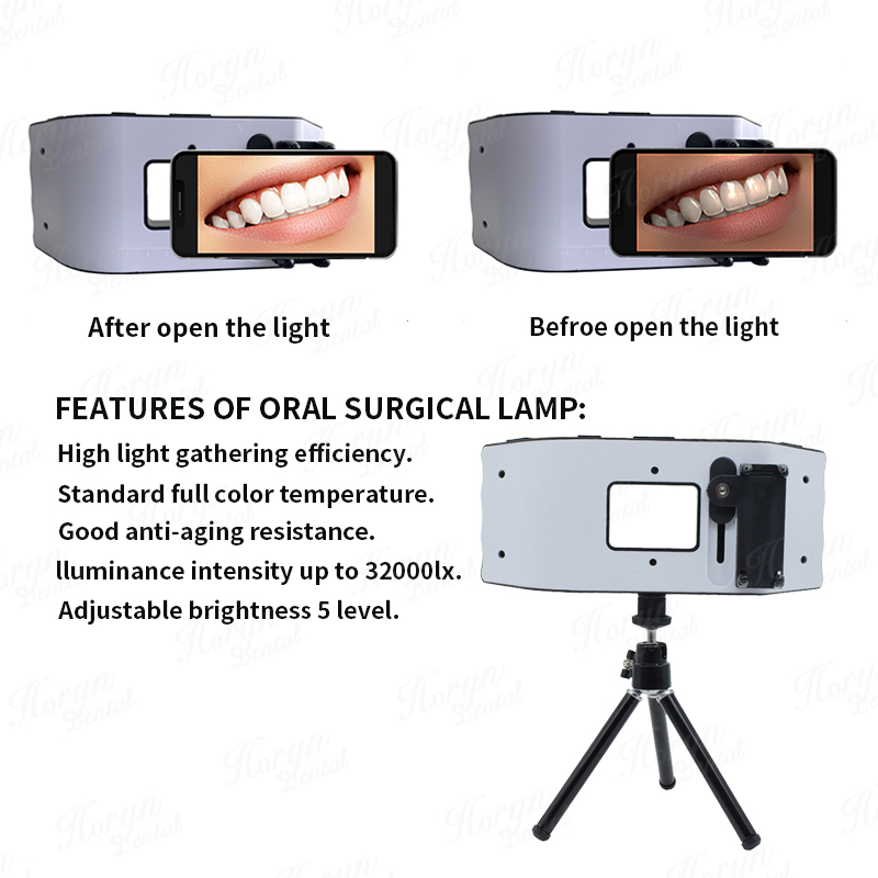 Luz de Flash Dental, equipo de - Photography Dental reseña y precio
